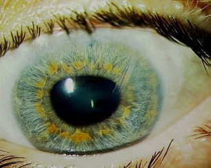 Slit-lamp photo 6 months after Baerveldt tube implantation (Figure 3)